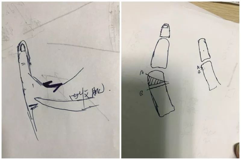 手术设计_副本.jpg